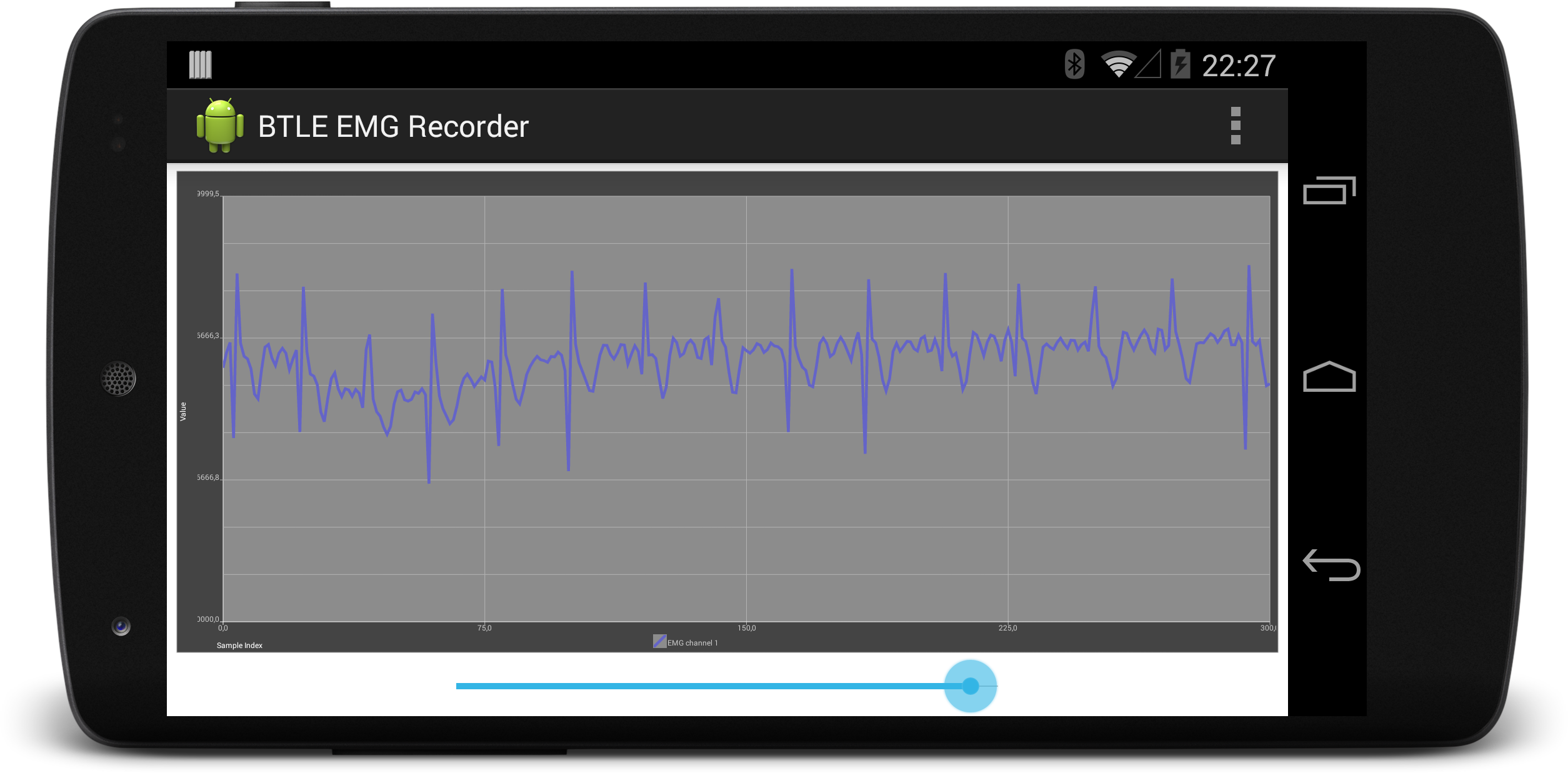 Sample ECG recording.